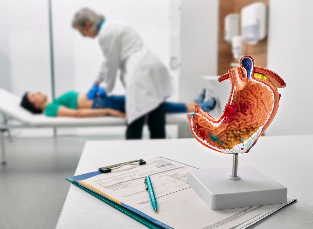 Rastreando la huella genética del cáncer gástrico