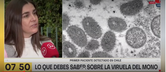 Entrevista a Dra. Lorena Tapia en 24 Horas AM de TVN, sobre primer caso de viruela del mono en Chile