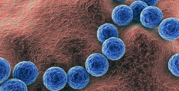 ¿Qué es la bacteria Streptococcus pyogenes?