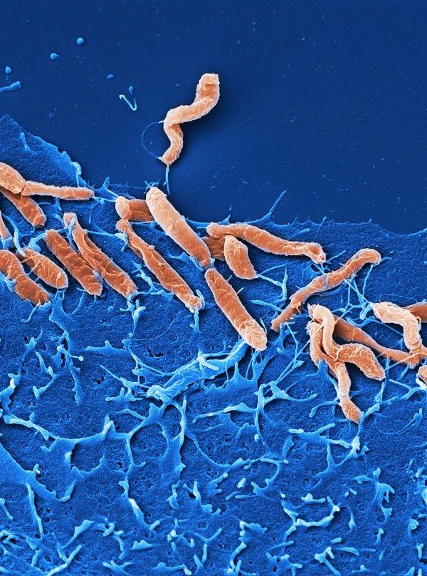 bacteria Helicobacter pylori